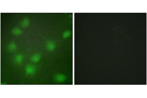 Immunofluorescence analysis of HuvEc cells, using HOXA11/D11 Antibody. (HOXA11/D11 抗体  (AA 216-265))
