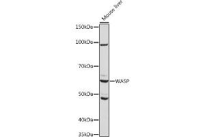 Western blot analysis of extracts of Mouse liver, using WASP Rabbit mAb (ABIN7271381) at 1:1000 dilution. (WASP 抗体)