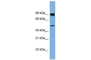 FAM160B1 antibody used at 1 ug/ml to detect target protein. (FAM160B1 抗体  (N-Term))