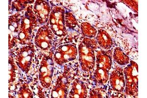 Immunohistochemistry of paraffin-embedded human small intestine tissue using ABIN7164219 at dilution of 1:100 (PFDN5 抗体  (AA 2-154))