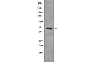 Western blot analysis of PBX3 using K562 whole cell lysates (PBX3 抗体  (N-Term))