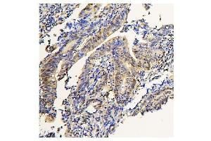 IHC analysis of ADK using anti-ADK antibody (ABIN7600222). (ADK 抗体  (AA 165-351))