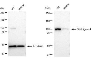 Western blotting analysis using DNA ligase 4 antibody (ABIN7799266). (Recombinant LIG4 抗体)