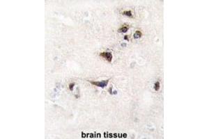 Immunohistochemistry (IHC) image for anti-Calcium/calmodulin-Dependent Protein Kinase II alpha (CAMK2A) antibody (ABIN3003046) (CAMK2A 抗体)