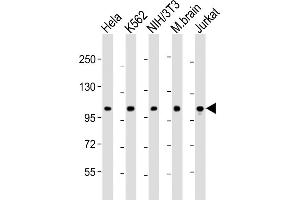 All lanes : Anti-DNM2 Antibody (N-Term) at 1:2000 dilution Lane 1: Hela whole cell lysate Lane 2: K562 whole cell lysate Lane 3: NIH/3T3 whole cell lysate Lane 4: mouse brain lysate Lane 5: Jurkat whole cell lysate Lysates/proteins at 20 μg per lane. (DNM2 抗体  (AA 213-247))