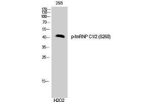 Western Blotting (WB) image for anti-Heterogeneous Nuclear Ribonucleoprotein C (C1/C2) (HNRNPC) (pSer260) antibody (ABIN3182632) (HNRNPC 抗体  (pSer260))