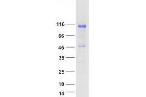 Western Blotting (WB) image for Nucleolar and Coiled-Body Phosphoprotein 1 (NOLC1) protein (Myc-DYKDDDDK Tag) (ABIN2727454)