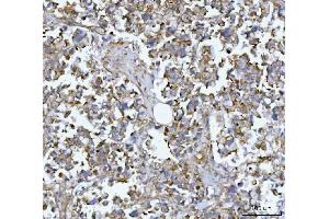 IHC analysis of MIM/MTSS1 using anti-MIM/MTSS1 antibody (ABIN7600276). (MTSS1 抗体  (AA 17-692))