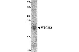 Western Blotting (WB) image for Mitochondrial Carrier 2 (MTCH2) (AA 29-174) protein (His tag) (ABIN2468870) (MTCH2 Protein (AA 29-174) (His tag))