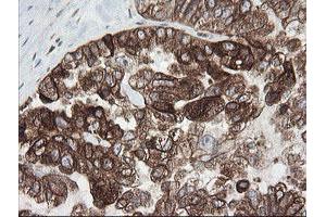 Image no. 7 for anti-TAP Binding Protein-Like (TAPBPL) antibody (ABIN1501300)