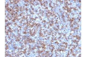 IHC testing of FFPE human lymphoma with recombinant CD8 antibody (clone C8/1779R).