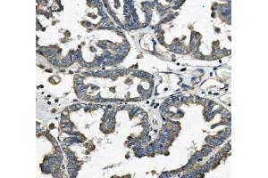 IHC analysis of FIS1 using anti-FIS1 antibody (ABIN7598965).