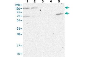 Western blot analysis of Lane 1: RT-4, Lane 2: U-251 MG, Lane 3: Human Plasma, Lane 4: Liver, Lane 5: Tonsil with MATR3 polyclonal antibody . (MATR3 抗体)