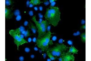 Anti-CCM2 mouse monoclonal antibody (ABIN2454979) immunofluorescent staining of COS7 cells transiently transfected by pCMV6-ENTRY CCM2 (RC201418). (CCM2 抗体)