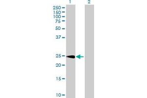Western Blot analysis of CPSF4 expression in transfected 293T cell line by CPSF4 MaxPab polyclonal antibody. (CPSF4 抗体  (AA 1-243))