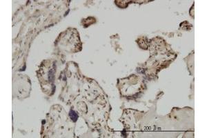 Image no. 3 for anti-Zic Family Member 4 (ZIC4) (AA 249-320) antibody (ABIN466252) (ZIC4 抗体  (AA 249-320))