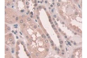 Immunohistochemistry (IHC) image for anti-NADPH Oxidase 1 (NOX1) (AA 235-488) antibody (ABIN7439315)