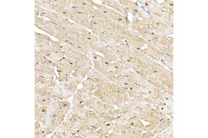 Immunohistochemistry of paraffin-embedded rat heart using PSM Rabbit pAb (752) at dilution of 1:50 (40x lens). (PSMA5 抗体  (AA 1-241))