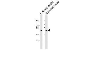 All lanes : Anti-MYL1 Antibody (N-Term) at 1:2000 dilution Lane 1: Human skeletal muslce lysate Lane 2: Rat skeletal muscle lysate Lysates/proteins at 20 μg per lane. (MYL1 抗体  (AA 24-58))
