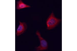 ABIN6261464 and ABIN6276554 staining HeLa cells by ICC/IF. (EGLN1 抗体  (Internal Region))