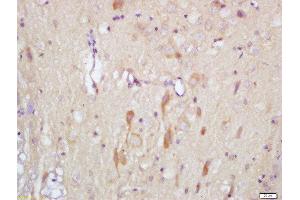 Formalin-fixed and paraffin embedded rat brain labeled with Rabbit Anti-Slitrk1 Polyclonal Antibody, Unconjugated (ABIN715556) at 1:200 followed by conjugation to the secondary antibody and DAB staining (SLITRK1 抗体  (AA 21-120))