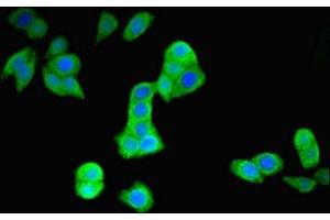 Immunofluorescent analysis of PC-3 cells using ABIN7151093 at dilution of 1:100 and Alexa Fluor 488-congugated AffiniPure Goat Anti-Rabbit IgG(H+L)
