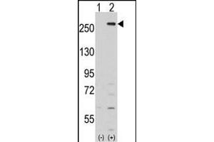 Western blot analysis of LMTK2 (arrow) using rabbit polyclonal LMTK2 Antibody (Center) (ABIN391210 and ABIN2841289). (LMTK2 抗体  (AA 668-697))