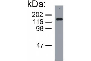Western blotting analysis of neurofilament medium protein in porcine brain lysate (reducing conditions) by mouse monoclonal NF-09. (NEFM 抗体)