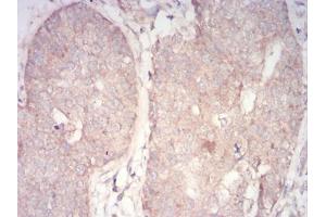 Immunohistochemistry (IHC) image for anti-3-phosphoinositide Dependent Protein Kinase-1 (PDPK1) (AA 457-556) antibody (ABIN5855659) (PDPK1 抗体  (AA 457-556))