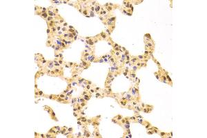 Immunohistochemistry of paraffin-embedded rat lung using SRSF1 Antibody. (SRSF1 抗体)