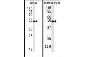 Image no. 1 for anti-Enolase 2 (Gamma, Neuronal) (ENO2) antibody (ABIN357944) (ENO2/NSE 抗体)