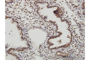 Immunoperoxidase of monoclonal antibody to SP1 on formalin-fixed paraffin-embedded human endometrium. (SP1 抗体  (AA 89-198))