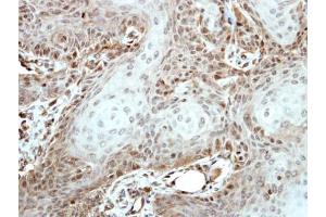 Immunohistochemistry (IHC) image for anti-POU Class 5 Homeobox 1 (POU5F1) antibody (ABIN2855068)