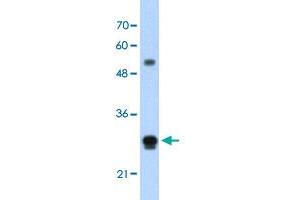 Western Blot analysis of HepG2 cell lysate with IGSF1 polyclonal antibody  at 1. (IGSF1 抗体  (N-Term))