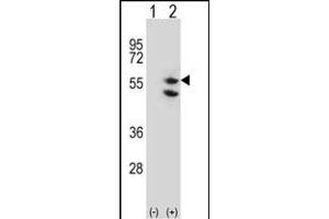 Western blot analysis of TUFM (arrow) using rabbit polyclonal TUFM Antibody (C-term) (ABIN656840 and ABIN2846048). (TUFM 抗体  (C-Term))