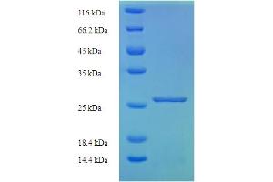 SDS-PAGE (SDS) image for Murinoglobulin 1 (Mug1) (AA 700-910), (partial) protein (His tag) (ABIN5710860) (Murinoglobulin 1 Protein (Mug1) (AA 700-910, partial) (His tag))