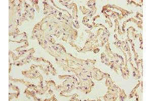Immunohistochemistry of paraffin-embedded human lung tissue using ABIN7175170 at dilution of 1:100 (RAD23A 抗体  (AA 2-201))