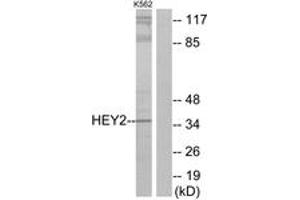 Western Blotting (WB) image for anti-Hairy/enhancer-of-Split Related with YRPW Motif 2 (HEY2) (AA 21-70) antibody (ABIN2889788)