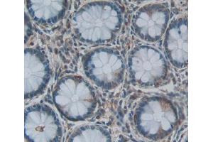 Immunohistochemistry (IHC) image for anti-Acylphosphatase 2, Muscle Type (Acyp2) (AA 2-99) antibody (ABIN5013081)