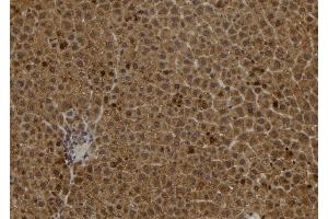 ABIN6278237 at 1/100 staining Rat liver tissue by IHC-P. (S100A2 抗体)