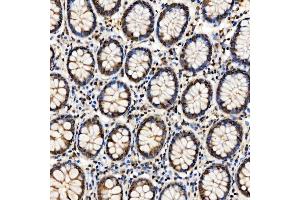 IHC analysis of SMARCA2/BRM using anti-SMARCA2/BRM antibody (ABIN7601969).