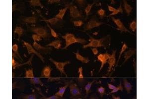 Immunofluorescence analysis of C6 cells using UFC1 Polyclonal Antibody at dilution of 1:100 (40x lens). (UFC1 抗体)