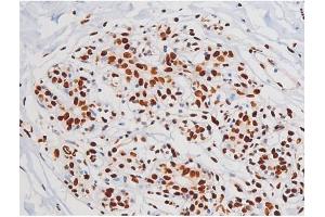 Immunohistochemistry (IHC) image for anti-Mast/stem Cell Growth Factor Receptor (KIT) (pTyr721) antibody (ABIN6256004)