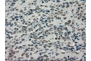 Image no. 12 for anti-TYRO3 Protein Tyrosine Kinase (TYRO3) antibody (ABIN1501607)