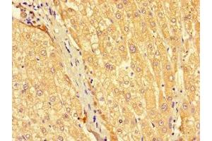 Immunohistochemistry of paraffin-embedded human liver tissue using ABIN7175490 at dilution of 1:100 (SEC22A 抗体  (AA 10-187))