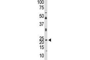 Image no. 1 for anti-Neurogenin 1 (NEUROG1) (N-Term) antibody (ABIN357407) (Neurogenin 1 抗体  (N-Term))