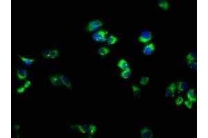 Immunofluorescence staining of PC-3 cells with ABIN7167298 at 1:166, counter-stained with DAPI. (RAB33A 抗体  (AA 1-237))