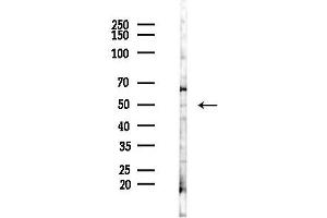 anti-Cardiolipin Synthase (CLS) (Internal Region) antibody