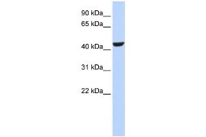 Western Blotting (WB) image for anti-Retinol Dehydrogenase 16 (All-Trans) (RDH16) antibody (ABIN2458627)