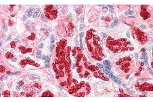 Detection of HBa1 in Human Erythrocytes of Placenta Tissue using Polyclonal Antibody to Hemoglobin Alpha 1 (HBa1) (HBA1 抗体  (AA 1-142))